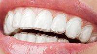 Los adultos ya suponen el 50% de los tratamientos de ortodoncia
