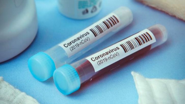 Los laboratorios farmacéuticos ya cuentan con 20 vacunas en desarrollo contra el coronavirus