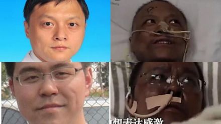 Dos médicos chinos cambian su color de piel tras padecer coronavirus