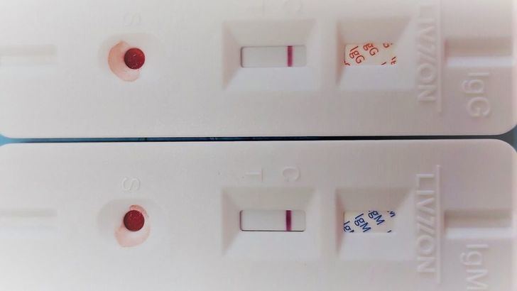 La circulación del virus es inexistente o los test son muy malos