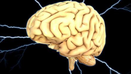 Ictus: Tú puedes detectar a tiempo un accidente cerebrovascular