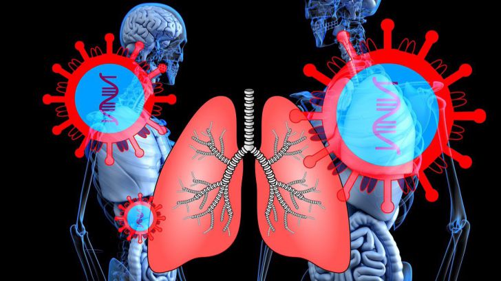 El Covid-19 presenta un nuevo concepto trascendental: la 'neumólisis'