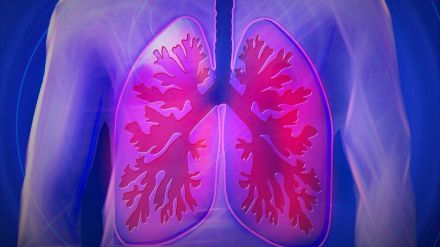 La evidencia científica apoya el cribado del cáncer de pulmón