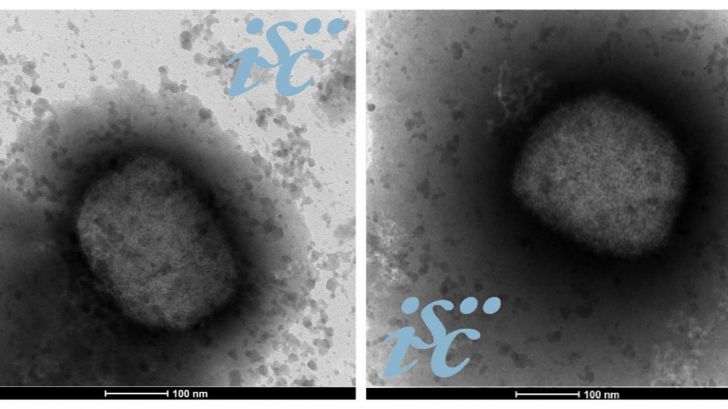 Nuevo hito: Investigadores españoles obtienen la secuencia completa del genoma del virus de la viruela del mono