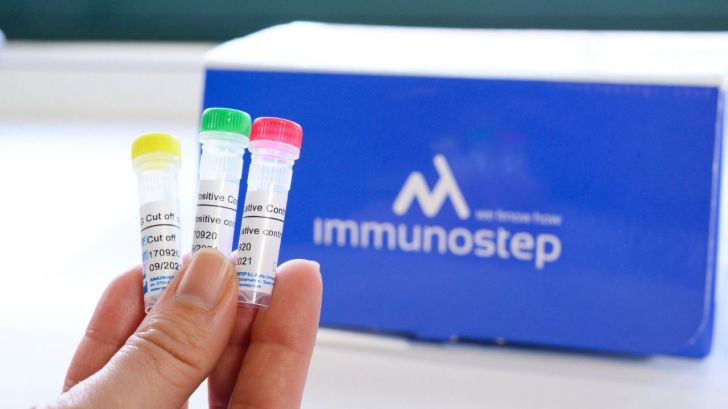 Los test serológicos para la COVID-19 llegan a países en vías de desarrollo