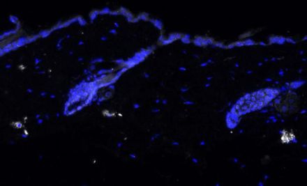 Tinción de inmunofluorescencia de IL-17 (en blanco) en piel de ratón envejecido. IRB Barcelona.