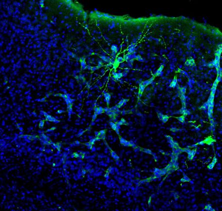 Metástasis en cerebro de ratón