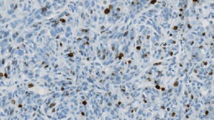 La duración del ciclo celular puede indicar riesgo de cáncer