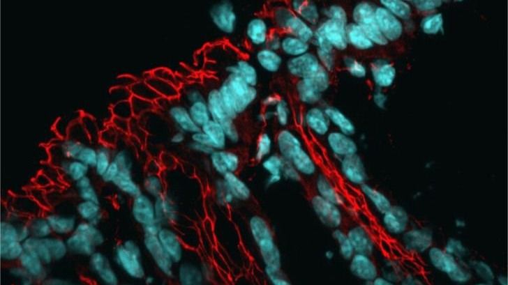 Identifican un mecanismo celular que afecta la microbiota intestinal y eleva el riesgo de enfermedades