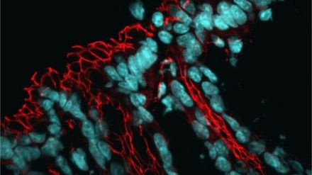 Identifican un mecanismo celular que afecta la microbiota intestinal y eleva el riesgo de enfermedades