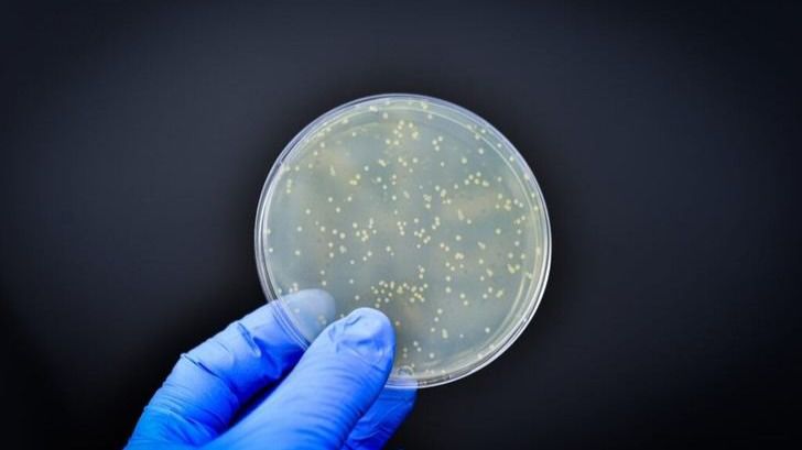 Estudio del CSIC revela resistencia bacteriana en la cadena alimentaria europea