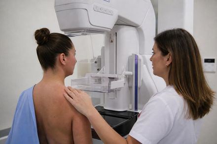 El cribado de cáncer de mama se mantiene por debajo de 2017 y agrava desigualdades