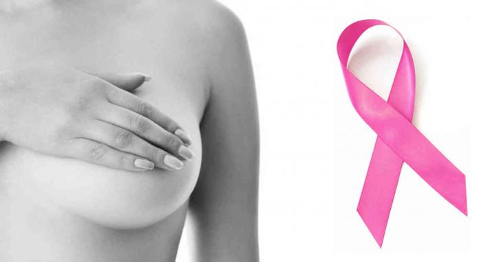 El cáncer de mama es el de mayor supervivencia en España