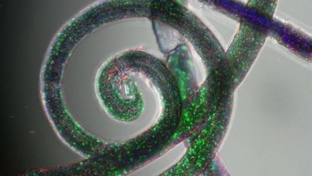 Desarrollan innovadores modelos 3D de cáncer en hidrogel para estudios más precisos