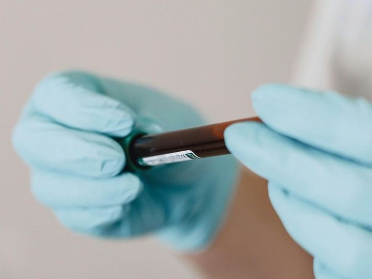 Identifican biomarcadores que predicen la diabetes tipo 2 años antes de su aparición