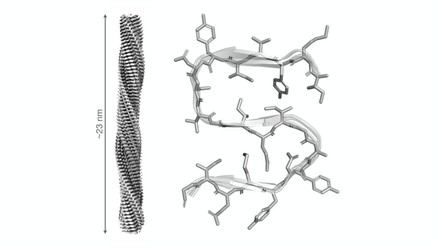 Científicos españoles revelan la estructura de una proteína clave en la muerte celular relacionada con enfermedades neurodegenerativas