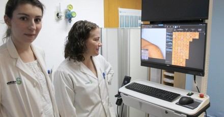 Castilla-La Mancha mejora la detección temprana del melanoma en Ciudad Real con nuevo equipo avanzado