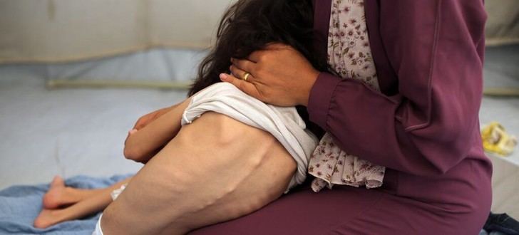 Crisis humanitaria en Gaza: hambre y calor extremo complican la situación