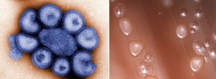 El orden de infección influye en la respuesta del sistema inmunitario ante virus y bacterias