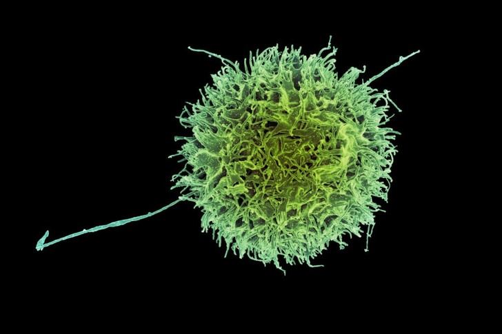 Células inmunitarias modificadas prometen avanzar en la lucha contra el cáncer