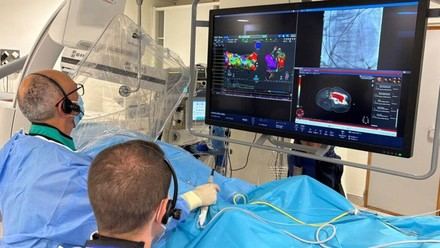 Innovadora tecnología permite mapear el corazón en tiempo real