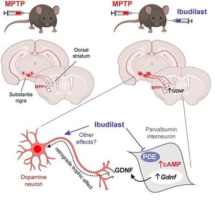 Ibudilast muestra eficacia en la protección de neuronas en modelos de Parkinson según investigadores del IBiS