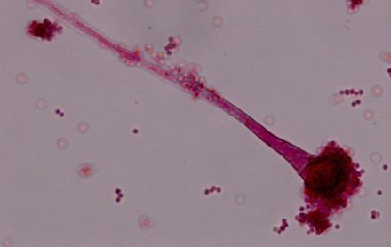 Expertos proponen un plan global para combatir la resistencia a los antifúngicos