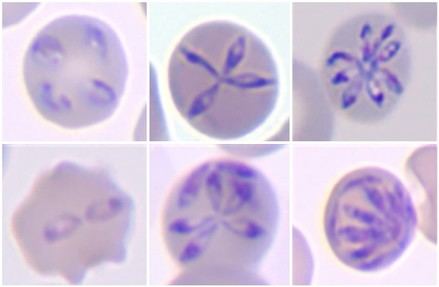 Nuevo parásito descubierto impulsa la investigación sobre la babesiosis humana