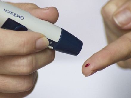 Fibrosis hepática y diabetes tipo 2 alteran el metabolismo en pacientes con hígado graso