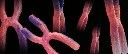 La Salle-URL lanza BeNeXT para mejorar el diagnóstico precoz del Síndrome de Turner