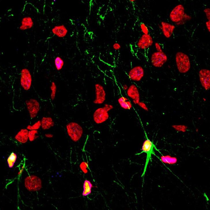 Impacto del consumo de sustancias y trastornos mentales en la neurogénesis cerebral