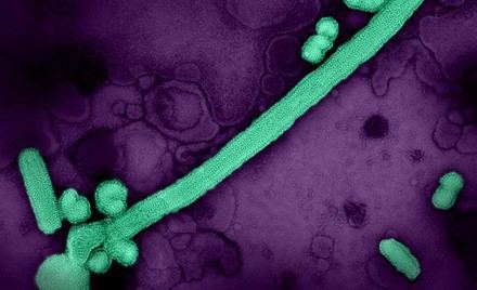 Las infecciones por gripe afectan a la microbiota pulmonar y favorecen la aparición de patógenos