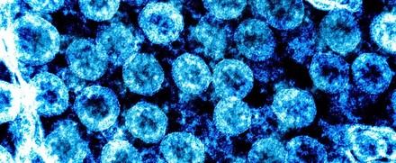 Diferencias de género en secuelas respiratorias post-COVID-19 relacionadas con telómeros