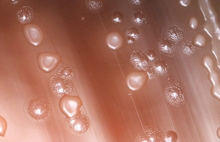 Avances en la eficacia de antibióticos contra el neumococo y sus resistencias