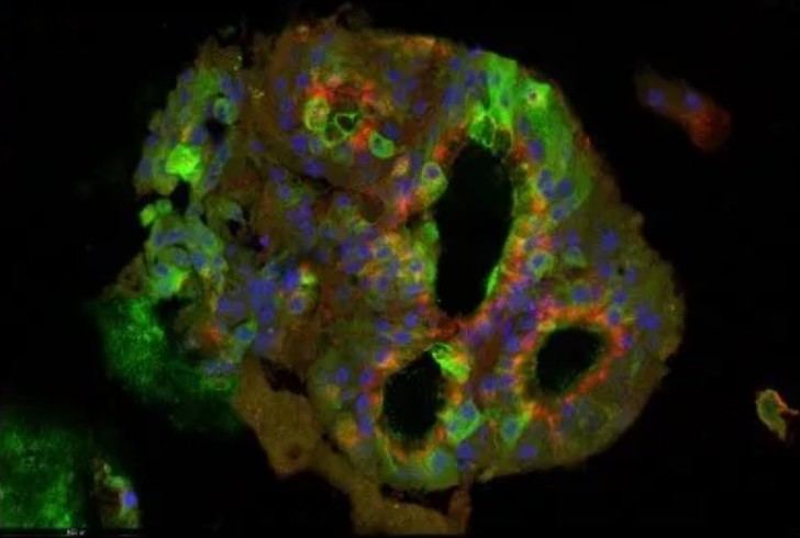 Organoides cerebrales: Avances en la investigación del cerebro humano