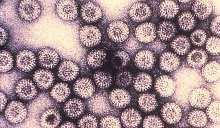 Estudio revela cómo el rotavirus afecta la hospitalización infantil y el papel de la vacunación
