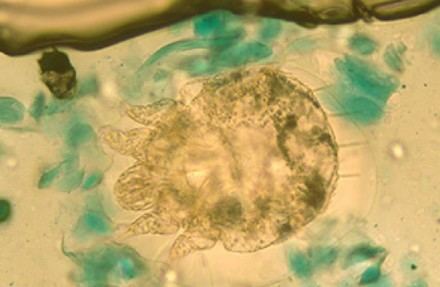 Un estudio del ISCIII alerta sobre el aumento significativo de los casos de sarna en España