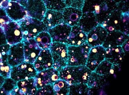 Descubren un mecanismo eficiente para eliminar células innecesarias en el cuerpo