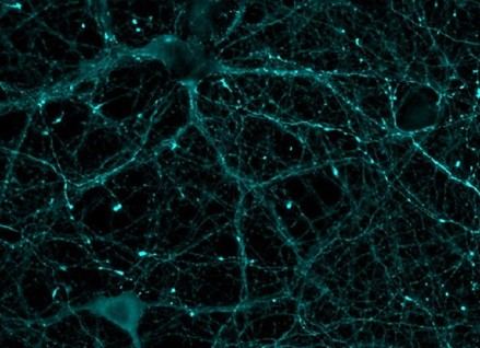 Desarrollan un sensor biológico que mide la actividad de una proteína vital para la memoria y el corazón