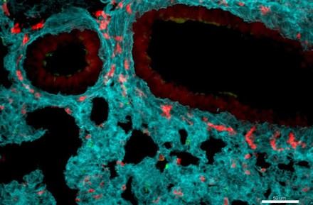 Investigación revela nuevas funciones de los neutrófilos y su potencial en tratamientos contra el cáncer e inflamación