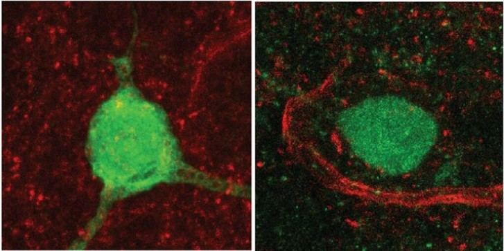 Identifican cómo una mutación genética relacionada con el autismo afecta la hormona de la sociabilidad