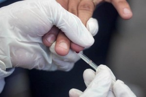 Un test de sangre para detectar el cáncer de pulmón